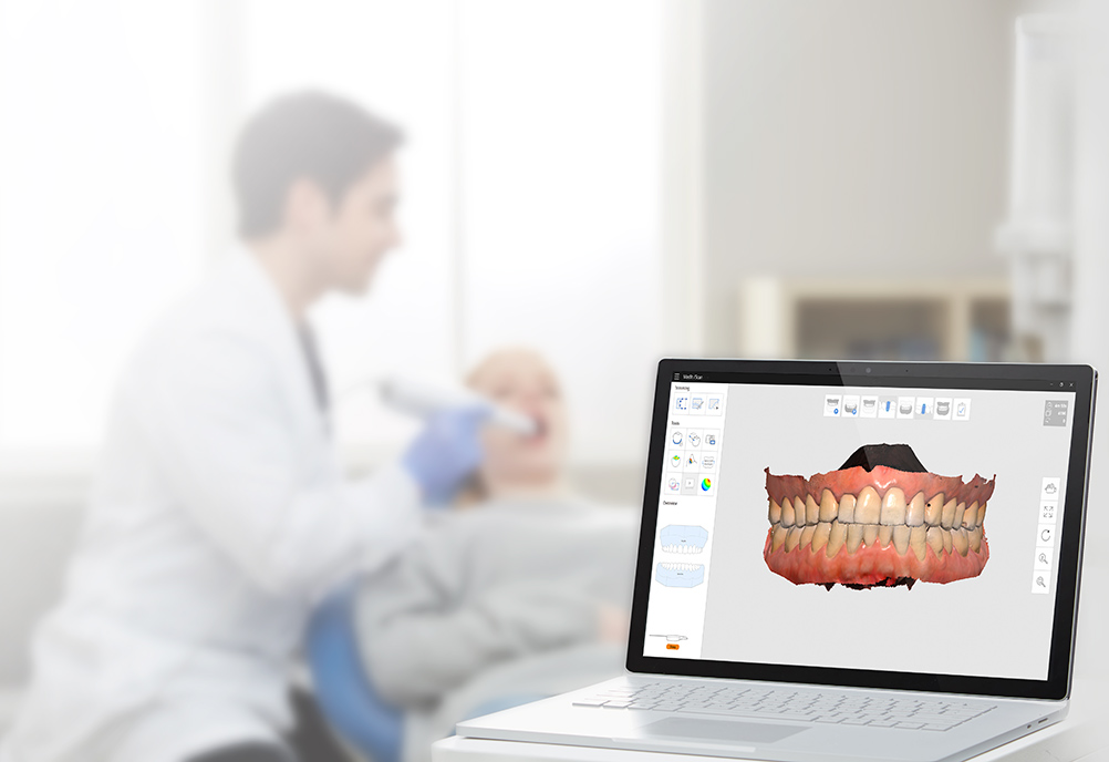 光学印象スキャナー 