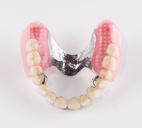 テレスコープデンチャー